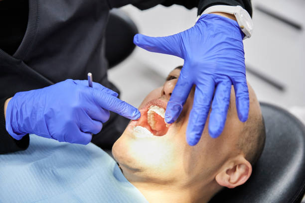 Best Broken Tooth Emergency  in Salem, UT